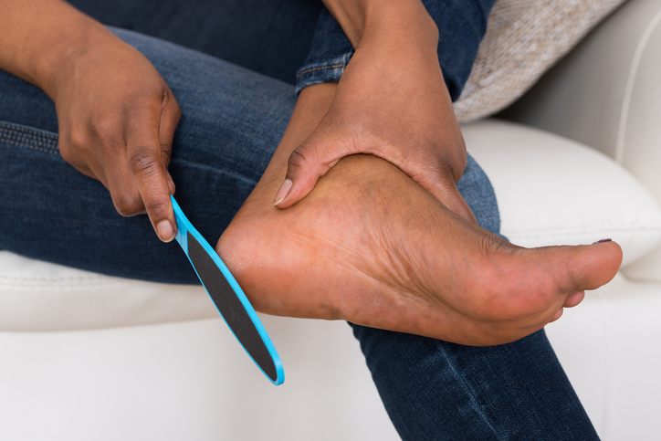 Treating Corn and Calluses Is Essential for Diabetics