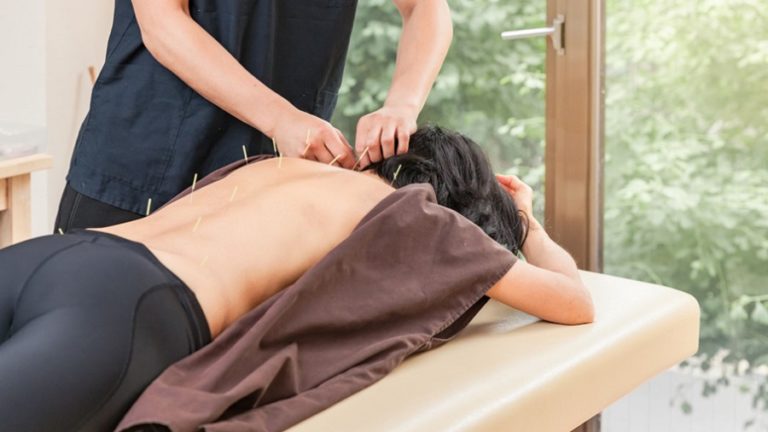 Treating Vertigo with Acupuncture: What to Expect?