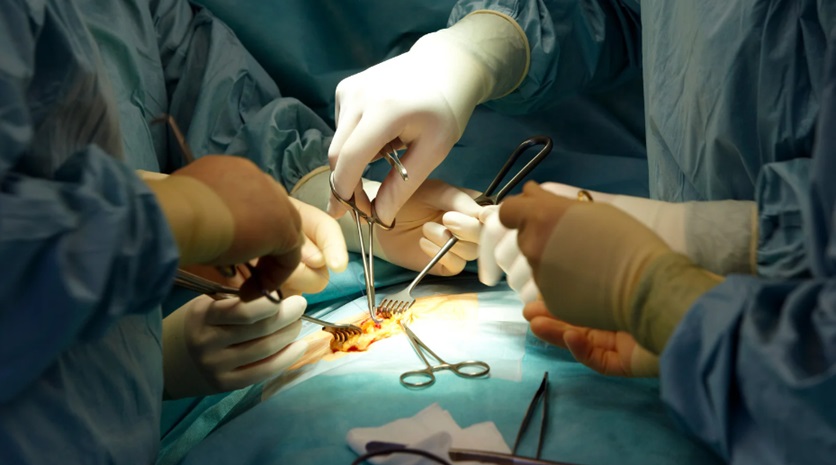 Bariatric Surgery