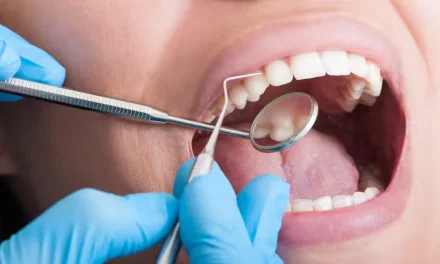 Why Professional Teeth Whitening Remains A Popular Choice For Brighter Smiles